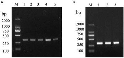 A novel reverse transcription recombinase polymerase amplification assay for rapid detection of GI.1 genotype of rabbit hemorrhagic disease virus